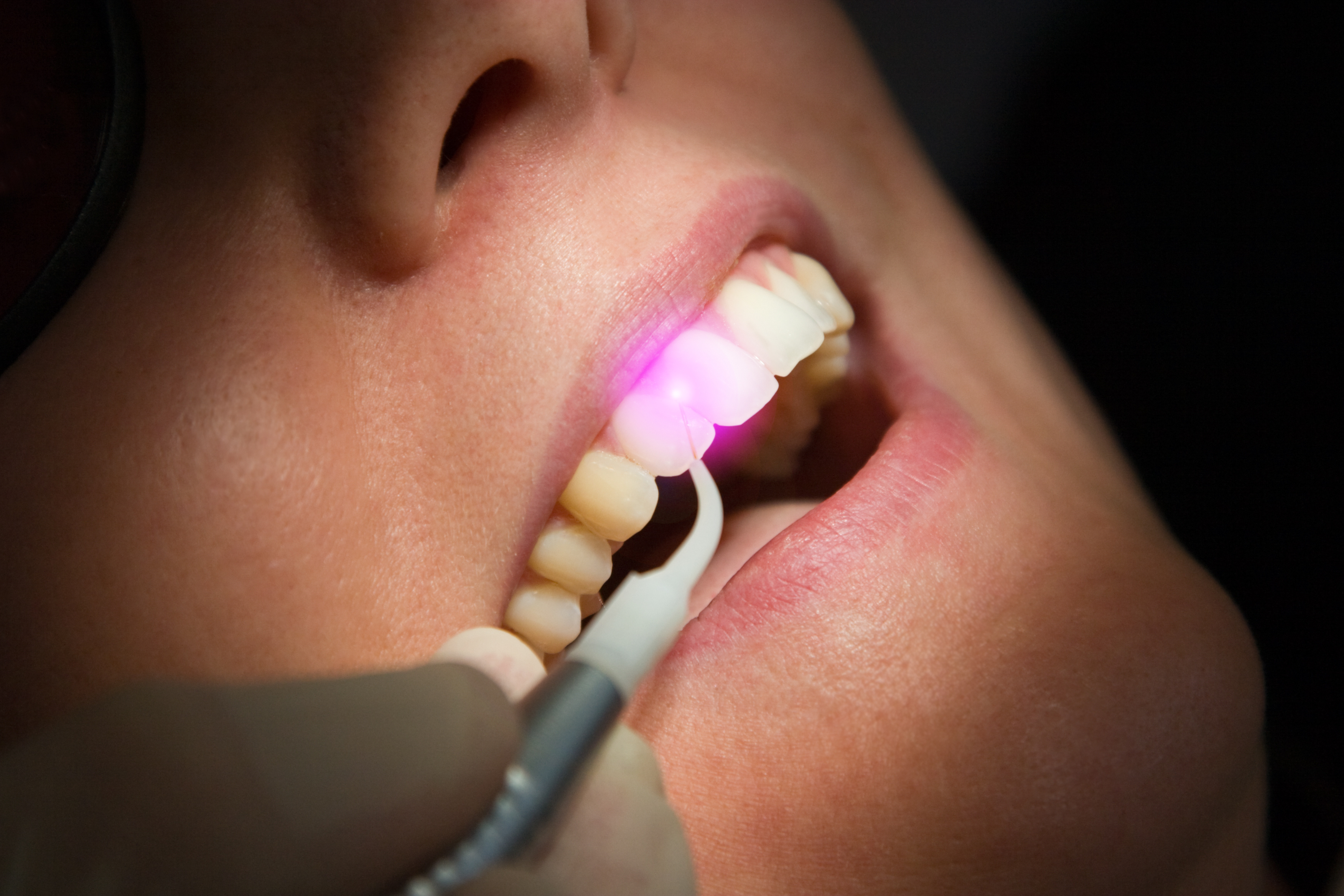 Are Lasers the Wave-Light of the Future?